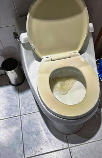 https://blockeddrainskoondoola.com.au/uploads/2025/07/blocked-toilet-27293.jpg
